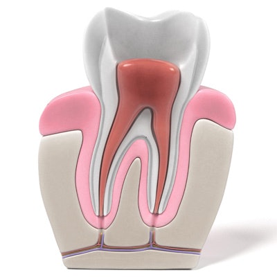 2017 01 25 17 32 55 822 Endodontics Root Canal 400