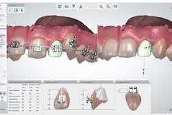 2017 04 17 09 24 23 645 3dshape Rmo 450
