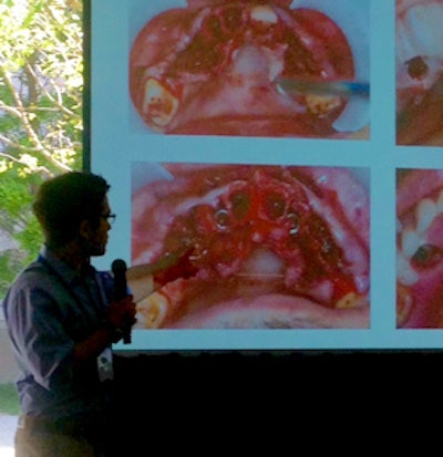 Ivan Cicchon, DDS, a prosthodontist from Stockton, CA, gives a presentation at the 3DHeals conference.