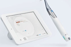 2017 04 28 13 43 33 286 Dentsply Sirona X Smart Iq Thumb