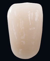 A single tooth from the Vitapan Excell line. Image courtesy of Vita North America.
