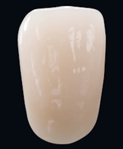 A single tooth from the Vitapan Excell line. Image courtesy of Vita North America.