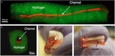 Representative images of prevascularized pulp-like tissue construct. (A) Longitudinal and (B) cross-sectional views of GelMA hydrogels loaded with green fluorescent microparticles showing the fabricated microchannel after being perfused with a red fluorescent microparticle solution. The channels cross the entire length of the root. (C,D) Photographs of GelMA hydrogels from longitudinal and occlusal perspectives inside a full-length root fragment. Root fragments were stabilized prior to hydrogel loading and microchannel fabrication, and were separated to retrieve the constructs and illustrate the position of the hydrogel inside the tooth. Microchannels were perfused with red food dye.