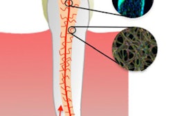 2017 06 21 11 50 42 663 2017 06 29 Pulp Regeneration Thumb2