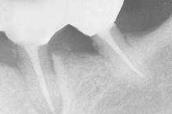 2017 06 26 10 19 59 351 2017 06 27 Berk Thumb