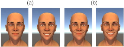 Dental show effect at different levels of angle-extent. Smiles with a smaller angle-extent combination (a) were rated better with no teeth shown, but those with a larger angle-extent combinations (b) were rated worse with no teeth shown. Image courtesy of PLOS One.