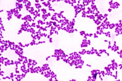 2017 07 20 16 05 36 875 Streptococcus Mutans 400