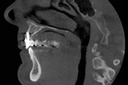 2017 08 09 20 29 13 26 Cbct Thumb 400