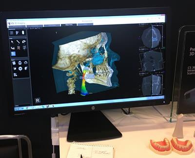 The CS Airway module in action at CDA Presents 2017.