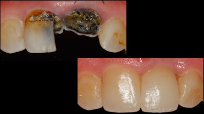 Figure 7: Before and after treatment images.