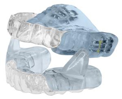 The Aligner Sleep Appliance. Image courtesy of SleepArchiTx.