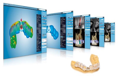 The Romexis implant guide module. Image courtesy of Planmeca.