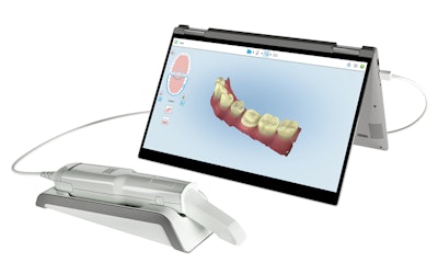 The iTero Element Flex. Image courtesy of Align Technology.