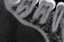 2018 10 09 22 14 4660 Image2 20181009230028
