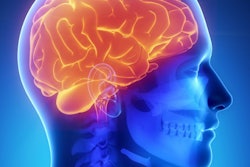 2018 10 26 19 00 1875 Brain General 400