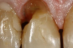 2018 12 10 21 31 8502 2018 12 11 Restoration3 20181210211403