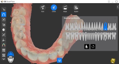An image from CS ScanFlow. Image courtesy of Carestream Dental.