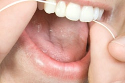 2016 08 03 14 23 11 590 Flossing 400