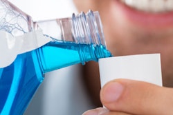 2017 01 10 17 09 31 816 Mouthwash Man 400