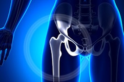 2019 06 27 22 45 2426 Hip Joint Female 400