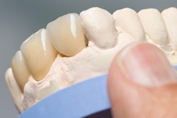 2019 07 11 19 31 4394 Dental Impression Denture 400