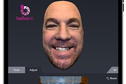 2019 07 17 18 31 4030 Bellus3 D Visual Aligner Tool 20190717182341