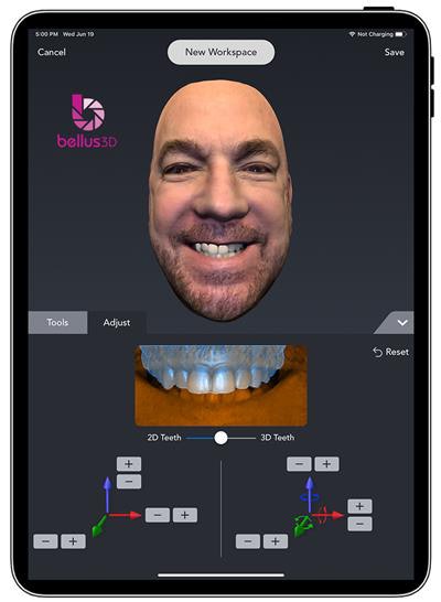 The Dental Pro app with Visual Smile Aligner tool. Image courtesy of Bellus3D.