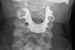 2019 08 13 16 32 6467 Bmj Dentures X Ray 20190813163806