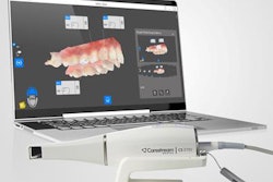 2019 09 05 18 15 0041 Carestream Dental Cs 3700 20190905182243