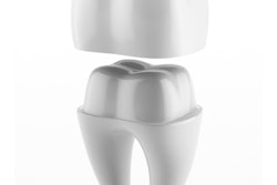 2017 01 18 12 22 46 330 Crown Tooth 400