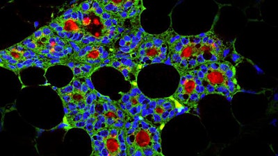 Histological section of a mouse mammary gland generated from dental stem cells (green) containing milk-specific protein casein (red). Image courtesy of the University of Zurich Institute of Oral Biology.