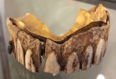 The teeth date back to between 1800 and 1850.