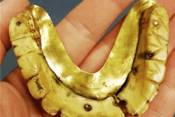 2019 11 14 17 11 0438 2019 11 14 Gold False Teeth2 20191114175836