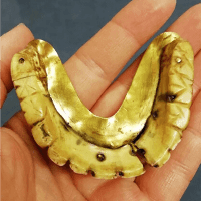 dentures with gold on them