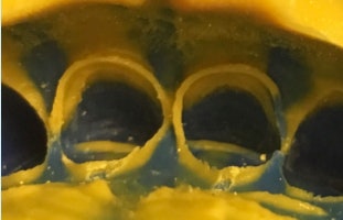 Image of retraction