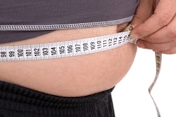 2019 12 10 21 09 1174 Obesity 400