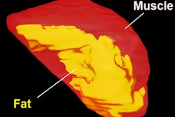 2020 01 10 18 53 8716 2020 01 10 Mri Sleep Apnea Thumb
