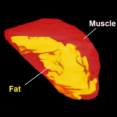 2020 01 10 18 53 8716 2020 01 10 Mri Sleep Apnea Thumb