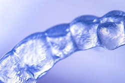 2018 09 25 21 02 5085 Clear Invisible Aligner 400