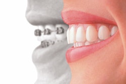 2019 06 14 17 16 9356 Invisalign 400
