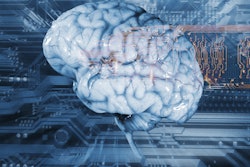 2020 02 03 17 23 7422 Artificial Intelligence Ai Brain 400