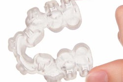 2020 02 04 00 12 0710 Pro3dure 3 D Printed Retainer 20200204003550