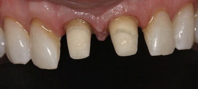 Two custom posts and cores