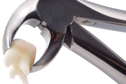 2019 09 03 21 36 9945 Dental Forceps Tooth 400