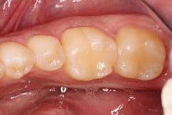 2020 03 04 20 51 7187 2020 03 05 Campbell1 20200304200859