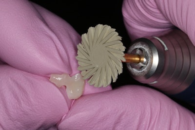 Restoration removed after try-in was polished using a Meisinger Twist Polisher for hybrid blocks.