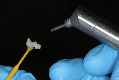 Above: Prior to cementation, the intaglio was microetched at 32 psi with 50-micron aluminum oxide particles. Below: Intaglio was then cleaned using 37% phosphoric acid for 5 seconds.