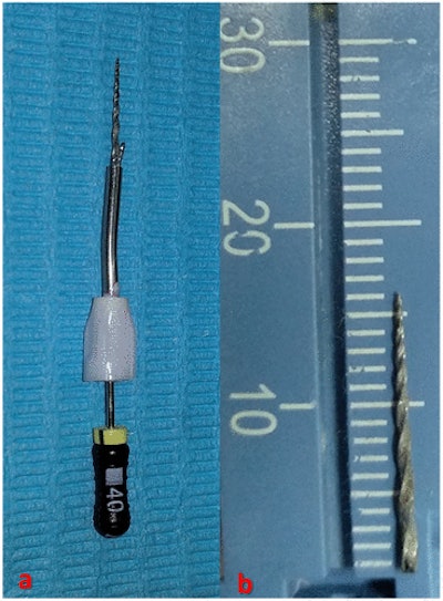 Separated instrument after it was removed from the canal. The removed separated instrument by hollow tube-based extractor (a) and (b) the length of the fragment was approximately 16 mm (b).