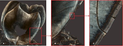 Panel A is a longitudinal section of a maxillary second molar of a 35-year-old woman who had two children. The next panel is a close-up of this section. The final panel shows at left, the dentine, covered, at right, by the cementum, which presents two distinct darker rings that correspond to the woman's two reproductive events. Image courtesy of Paola Cerrito.
