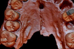 2020 04 06 17 07 1865 2020 04 07 Reconstruction Homo Antecessor 20200406183214